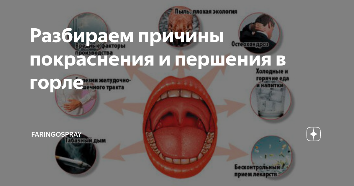 Как успокоить першение. Першение в горле причины. горло при вирусном заболевании.