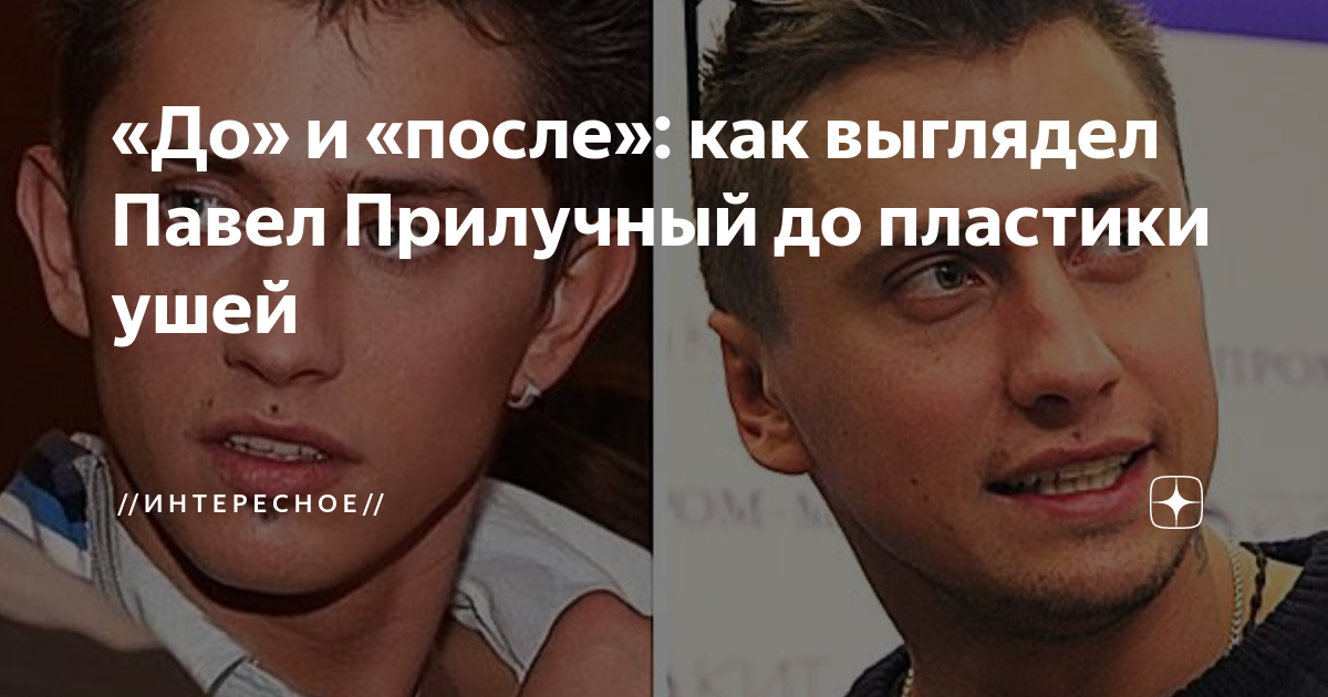 Уши прилучного до и после пластики Карина и павел прилучный фото, видео