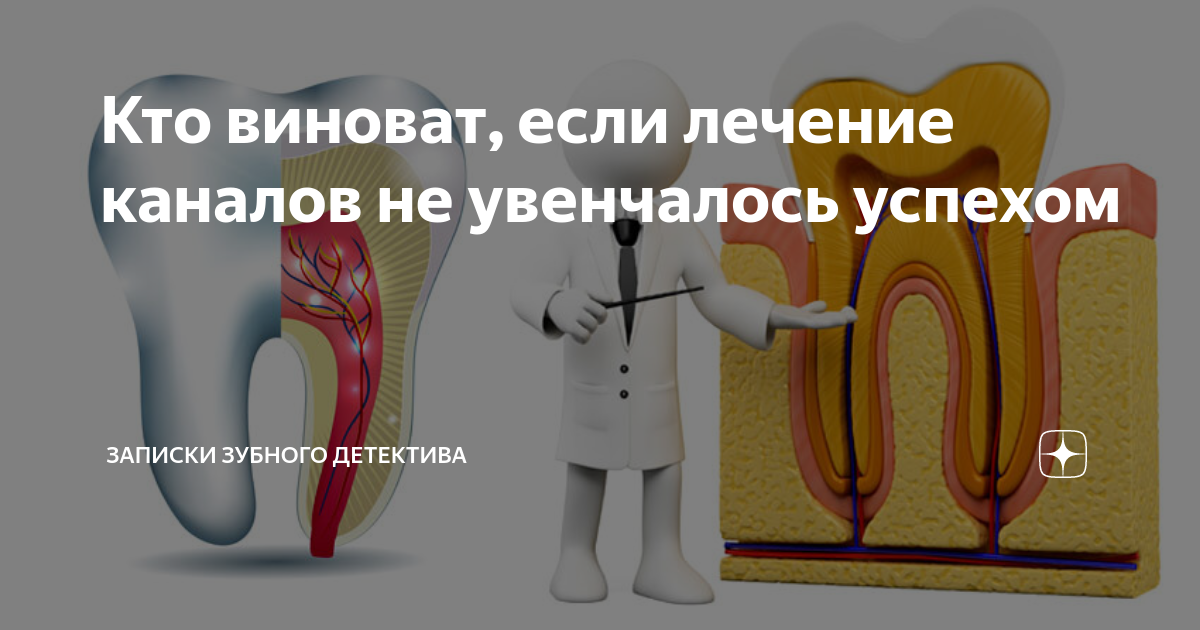 Как выглядят каналы в зубе. Записки зубного детектива. Записки зубного детектива дзен. Записки стоматолога детектива. Проволока для шинирования зубов купить.