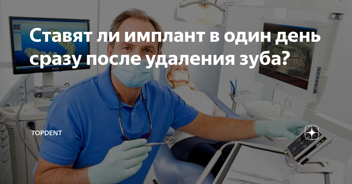Ставят ли имплант в один день сразу после удаления зуба? | TopDent | Дзен