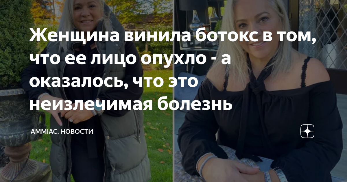 чешется тело и опухло лицо