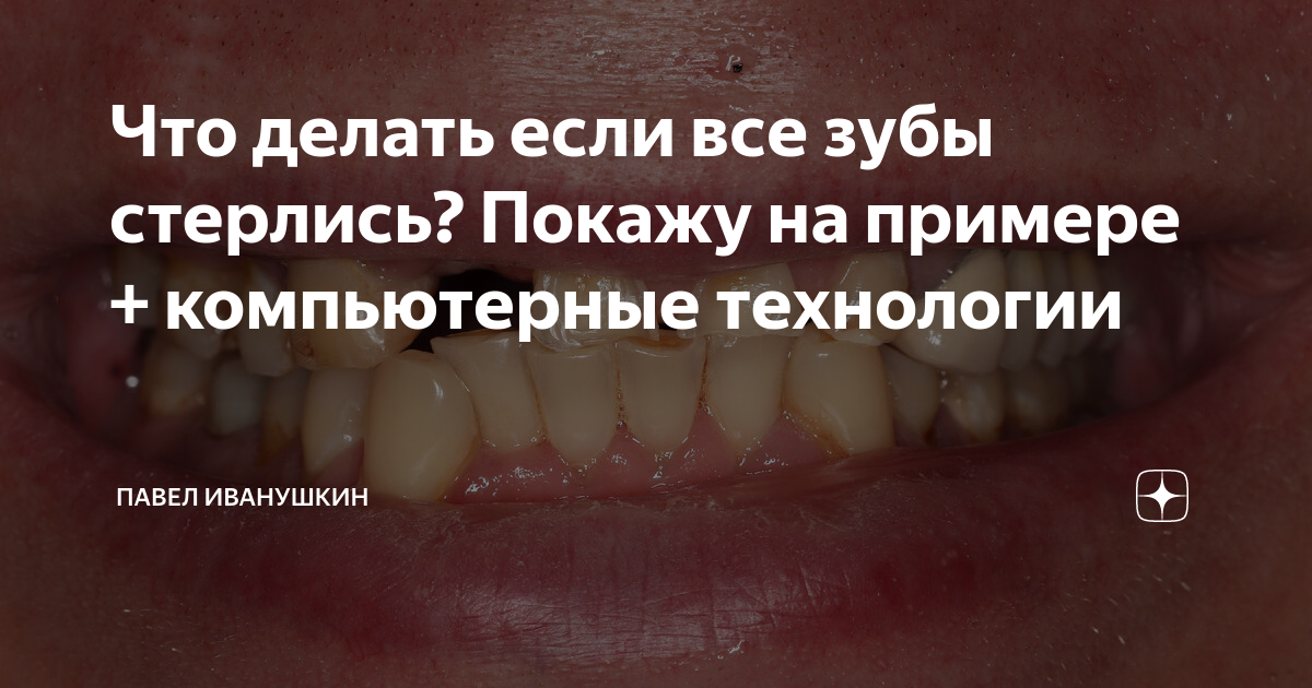 Если стерлись колодки