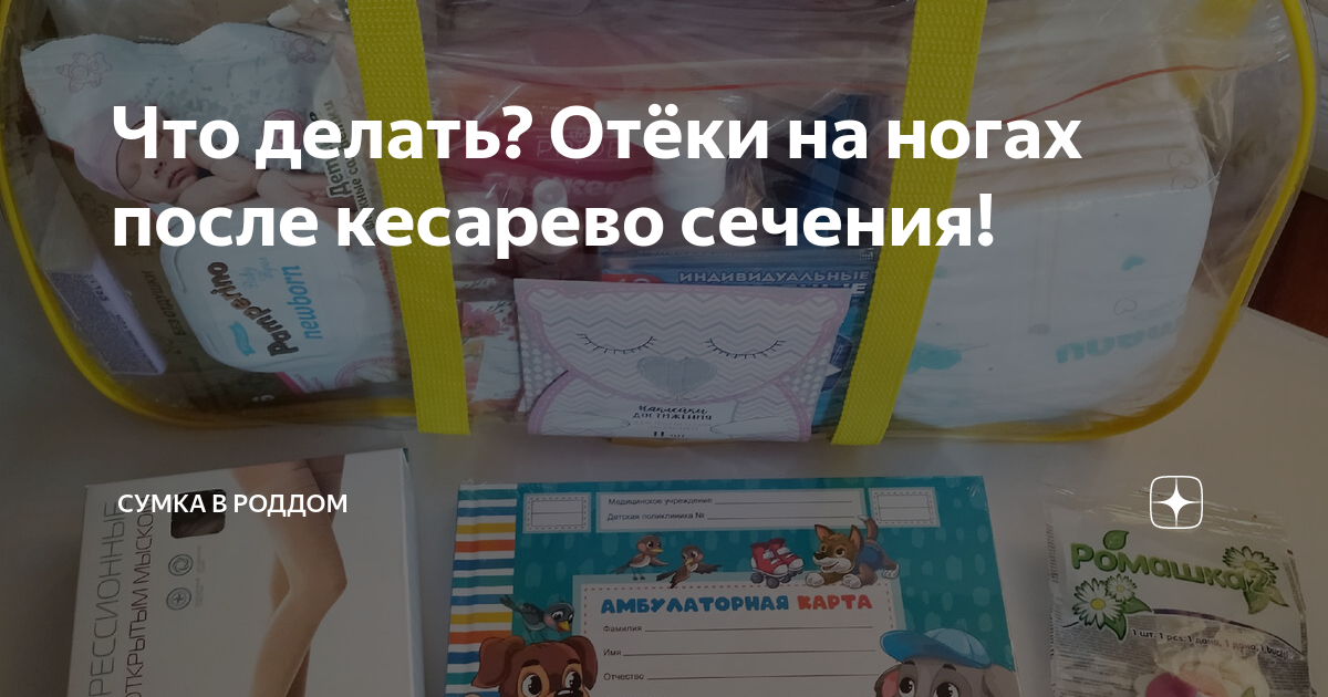 Почему отекают ноги? Диагностика, причины, способы уменьшить отечность и работают ли тейпы?