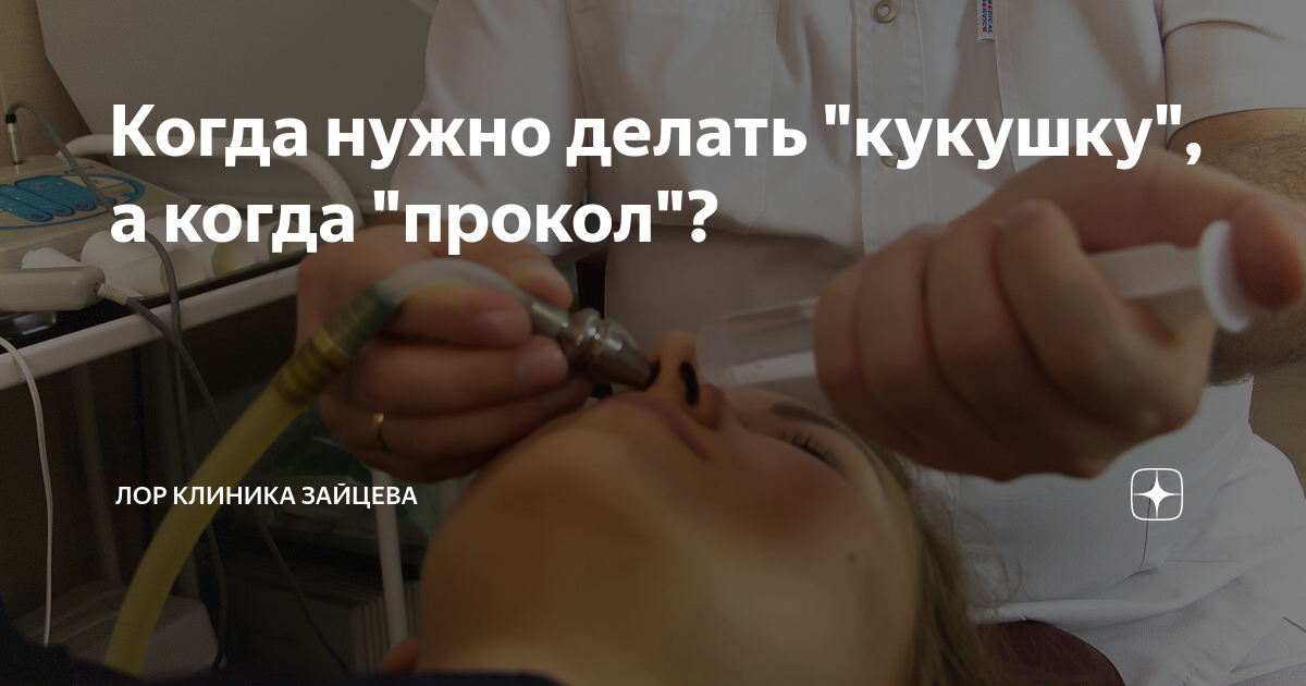 Когда нужно делать "кукушку", а когда "прокол"? | ЛОР КЛИНИКА ЗАЙЦЕВА ...