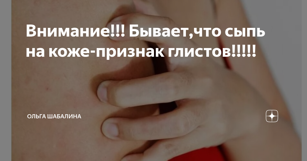 В Башкирии раскрыли данные по распространенности инфекции, считавшейся побежденн