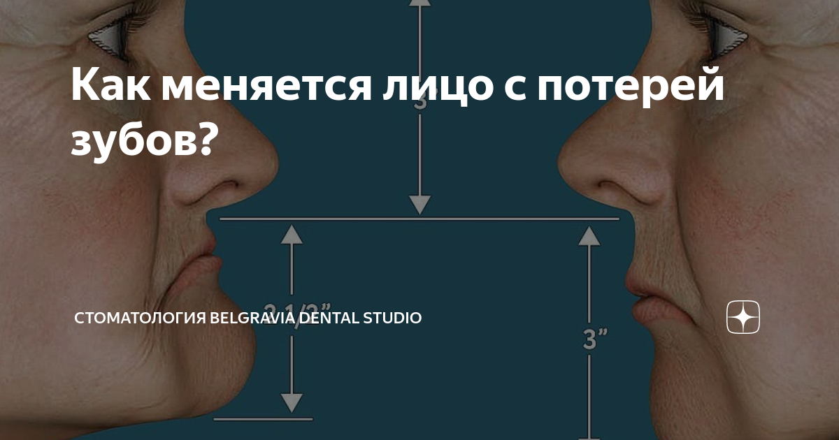 онемение языка после стоматолога