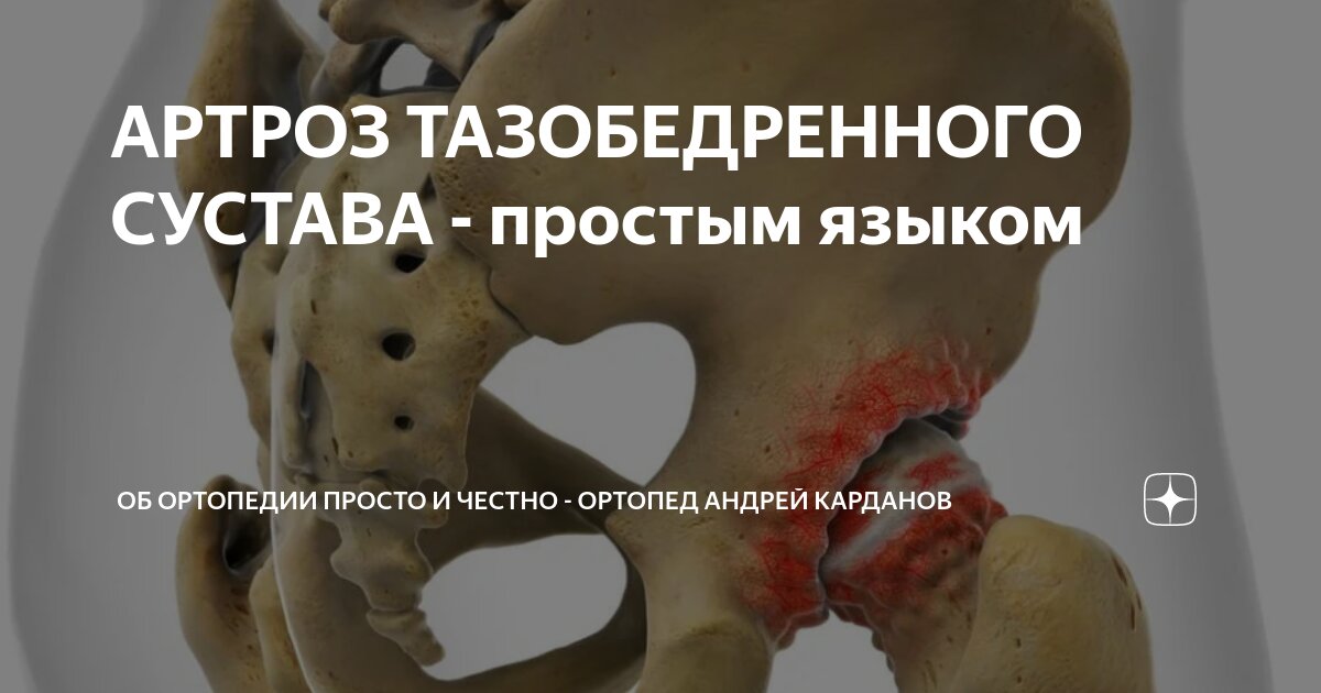 Незрелость тазобедренных суставов у новорожденных лечение. Незрелость тазобедренных суставов у новорожденных: признаки, лечение. Дисплазия тазобедренных суставов у детей: лечение у новорожденных. Незрелость тазобедренного сустава у новорожденных: причины и лечение