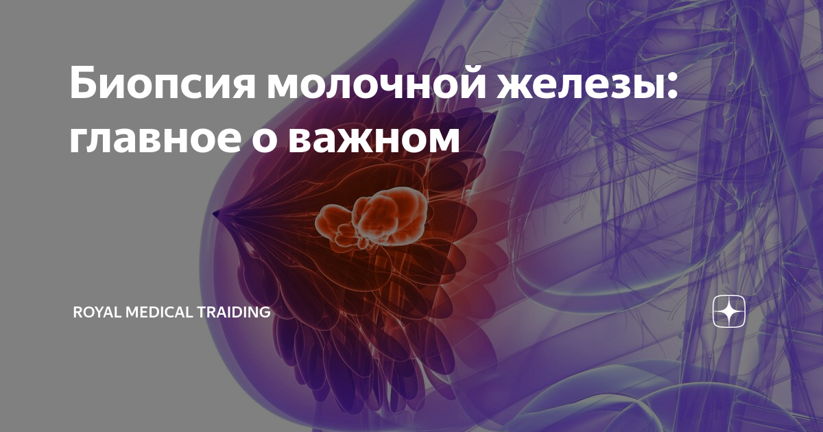 Биопсия молочной железы: главное о важном | Royal Medical Traiding ...