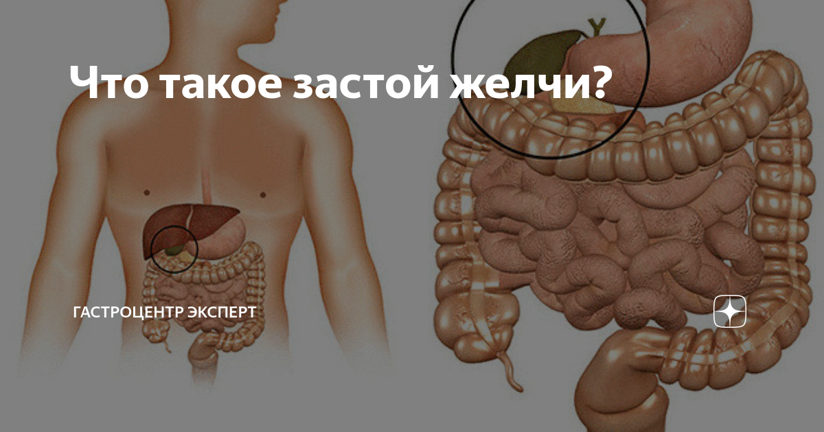 Что такое застой желчи? | Гастроцентр Эксперт | Дзен