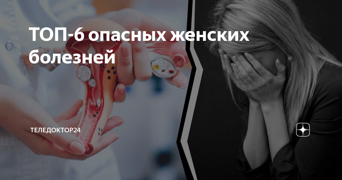ТОП-6 опасных женских болезней | Теледоктор24 | Дзен