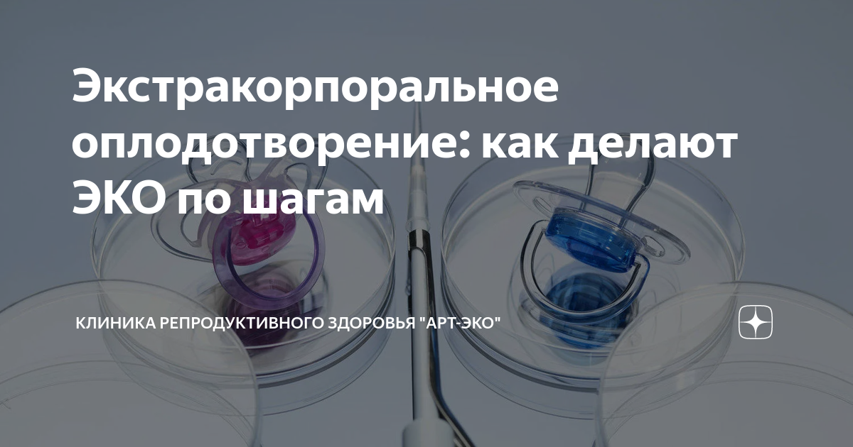 Экстракорпоральное оплодотворение: как делают ЭКО по шагам | Клиника ...