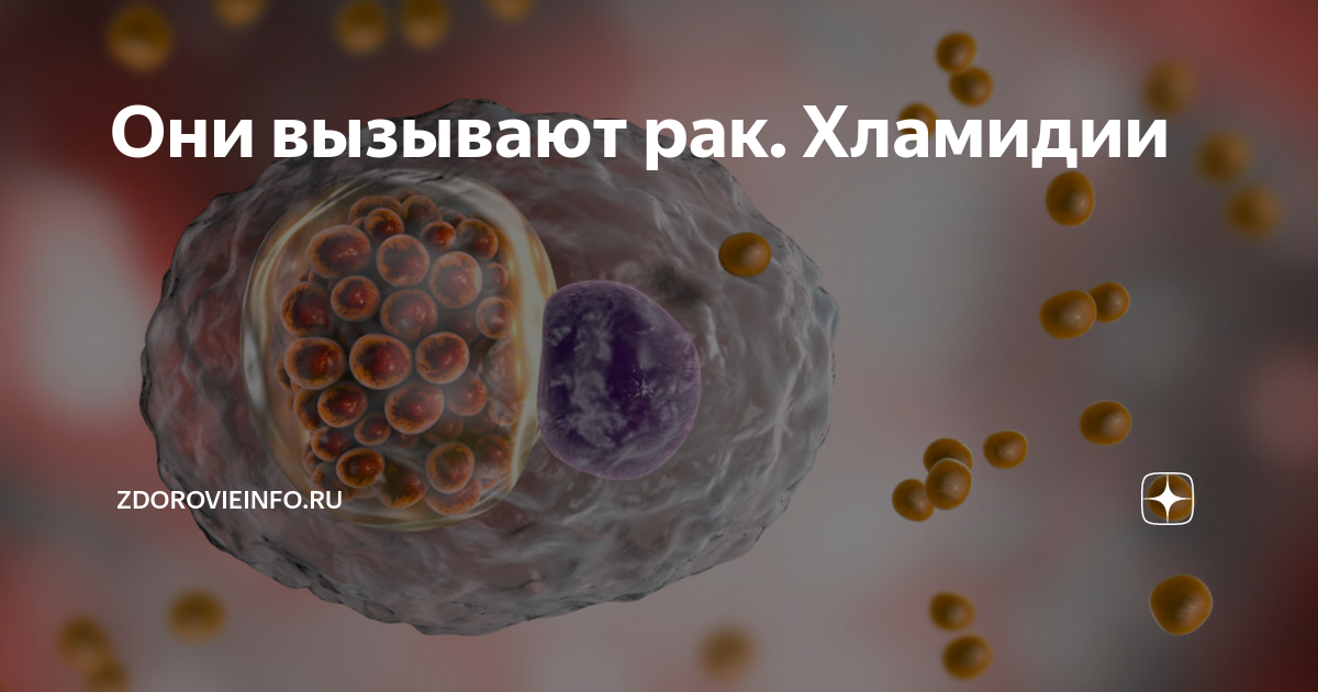 Какие хламидии вызывают артрит. Хламидии: что это такое, симптомы хламидиоза у женщин и мужчин, лечение. Хламидиоз у женщин - причины, симптомы, диагностика и лечение Лечение хламидиоза, уреаплазмоза и микоплазмоза. | Он-Лайн Клиник.