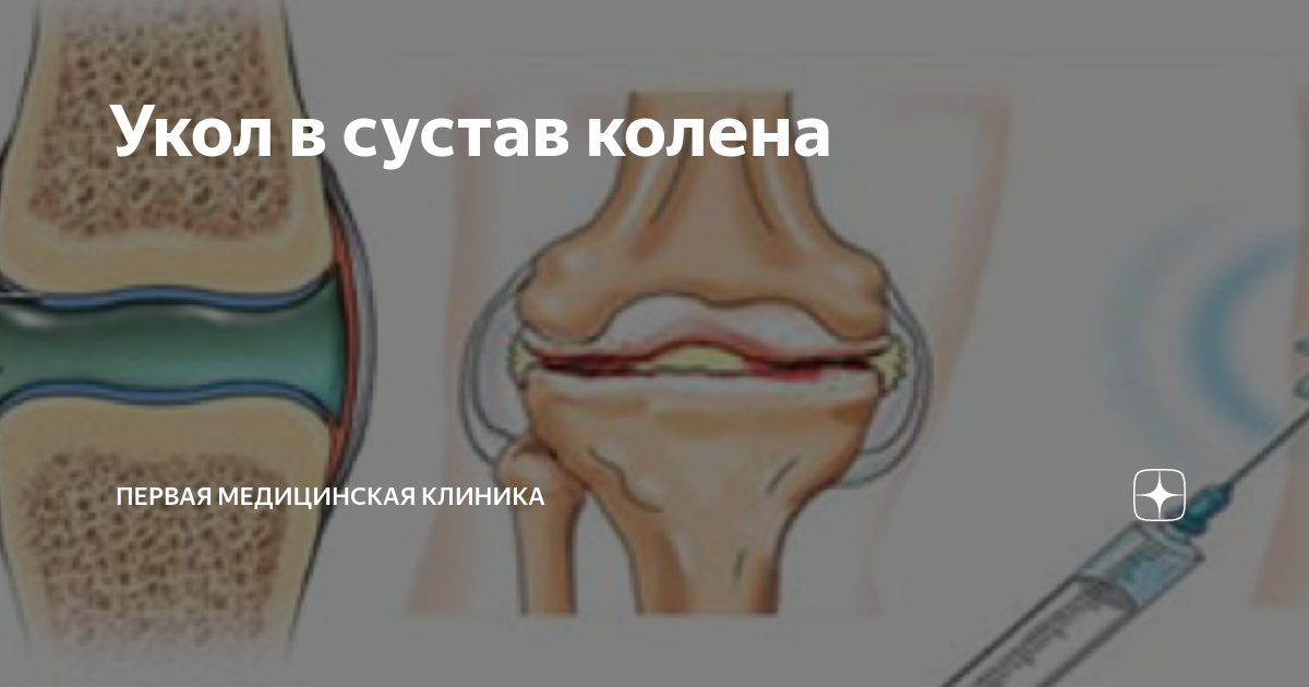уколы от боли в шейном отделе