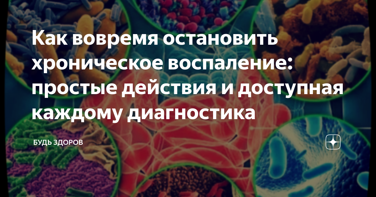 Лечение при воспалении сустава на ноге. Упражнения от косточки на ноге, гимнастика для лечения большого пальца ноги. Причины воспаления суставов на ногах: лечение и как снять воспаление. Растяжение связок голеностопного сустава