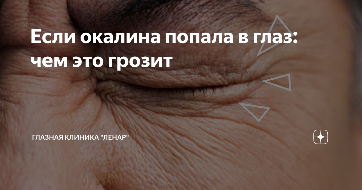 Если окалина попала в глаз: чем это грозит | Глазная клиника "ЛЕНАР" им ...