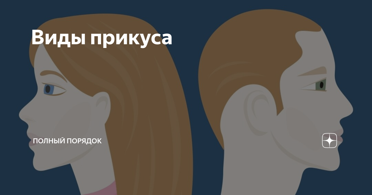 Виды прикуса | Полный порядок | Дзен