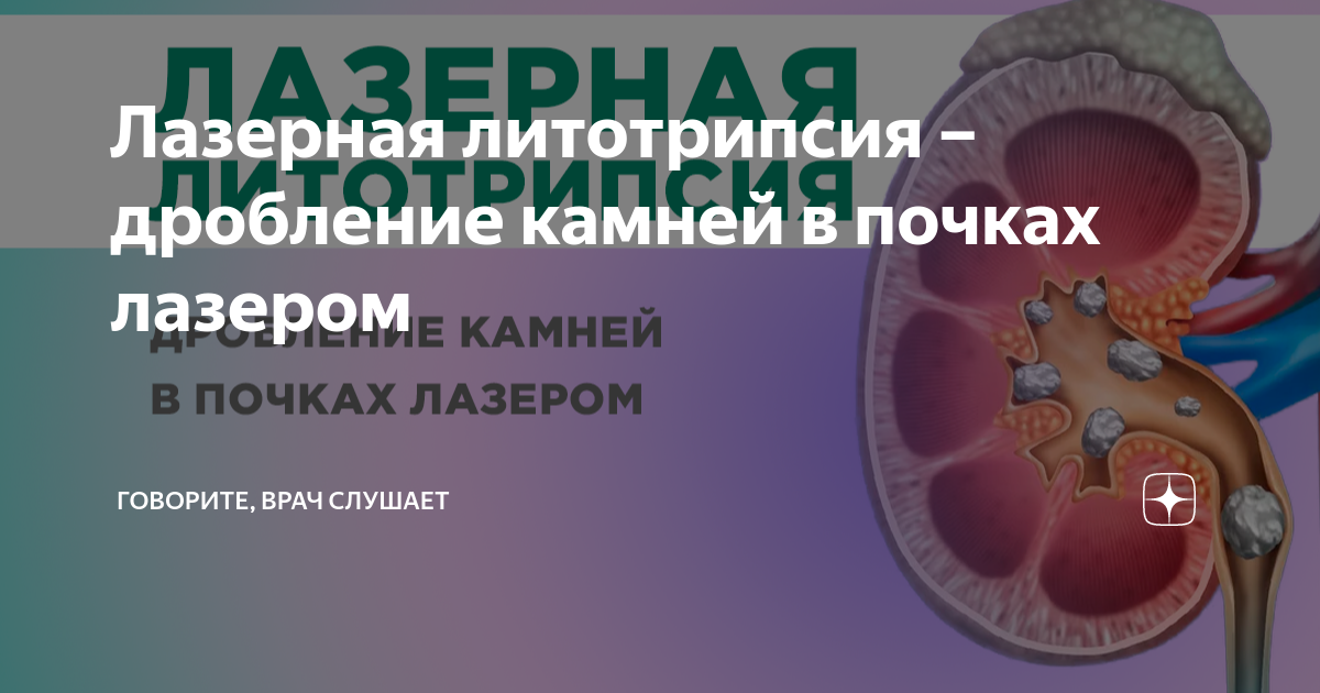 Дробление камня в почке отзывы. Инновационная хирургия камней почек и мочеточников книга. Камень в почечной лоханке. Инновационная хирургия камней почек и мочеточников Коган.