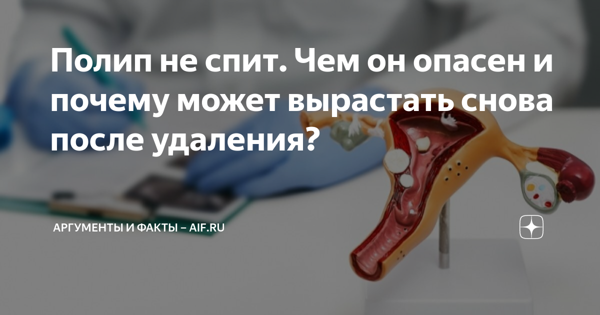 полип это