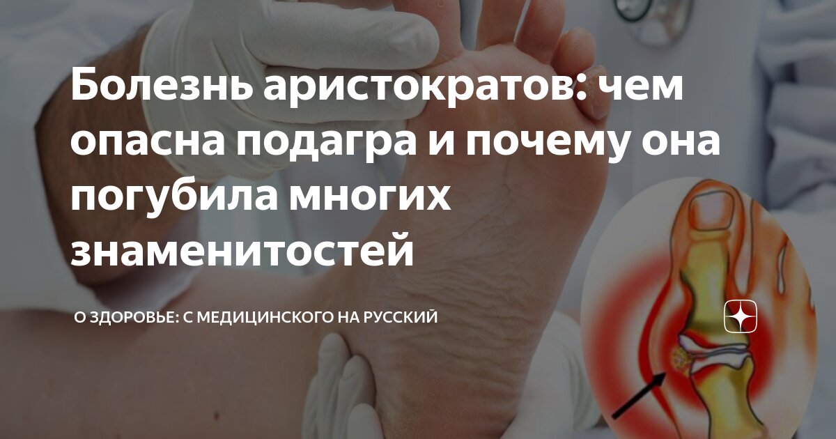 Если припух сустав мизинца. Купить разделитель для мизинца с защитным лепестком под стопу в. ORTGUT Силиконовый разделитель для мизинца с защитным лепестком под. Лечение артроза мелких суставов кистей рук, причины и симптомы заболевания