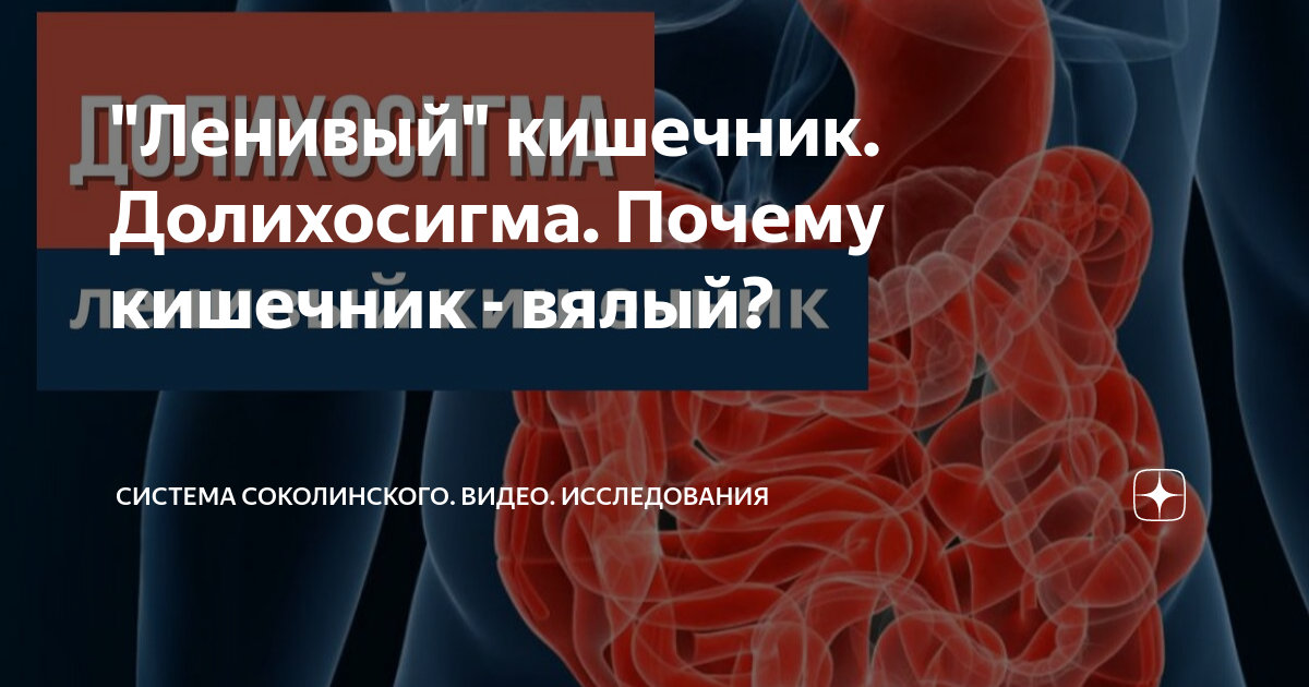 Долихосигма кишечника у взрослых симптомы лечение