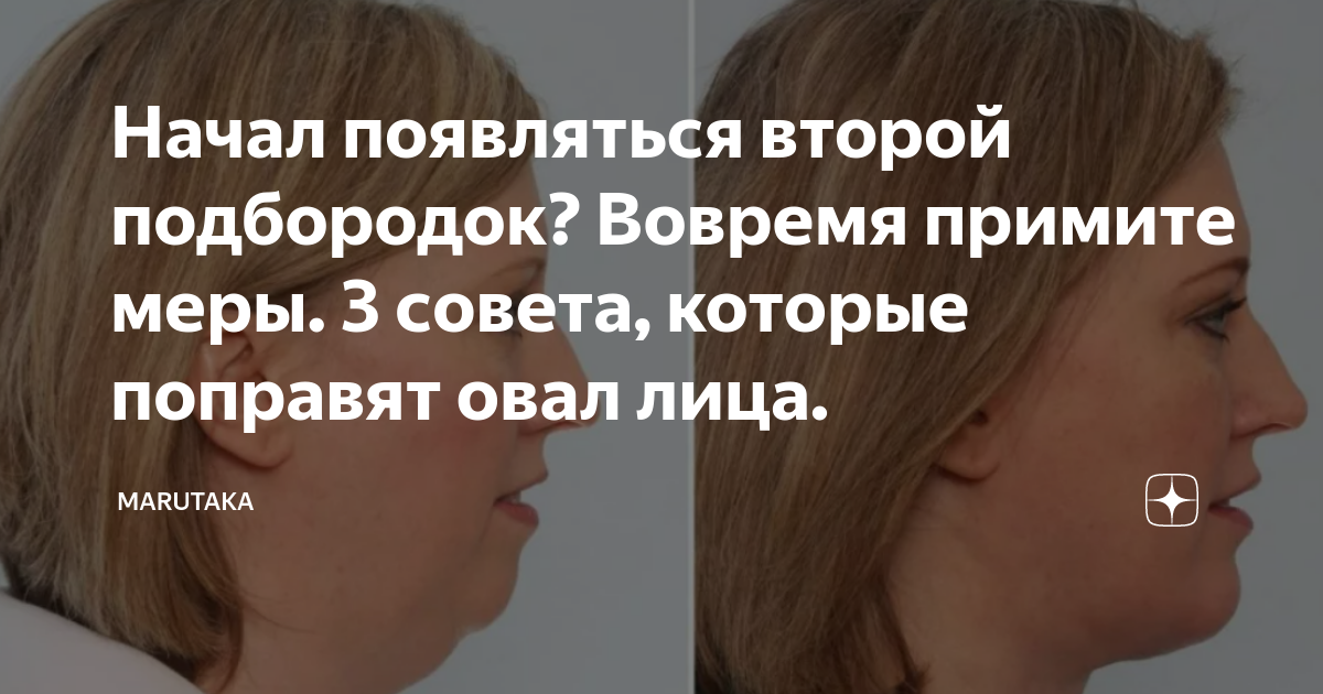 Начал появляться второй подбородок? Вовремя примите меры. 3 совета, которые  поправят овал лица. | Marutaka | Дзен