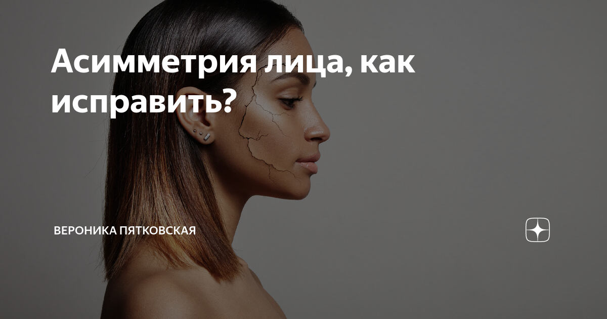 Асимметрия лица: что это, причины и коррекция филлерами