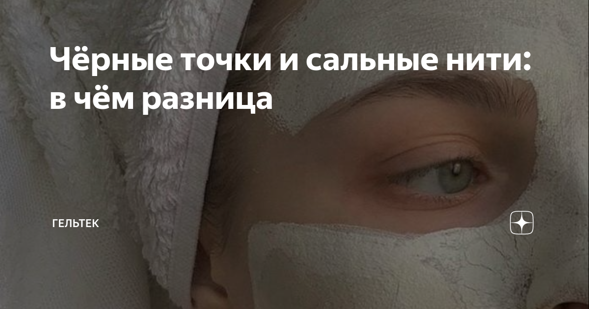 Чёрные точки и сальные нити: в чём разница | Гельтек | Дзен