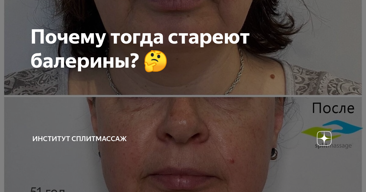 Почему тогда стареют балерины? 🤔 | Институт Сплитмассаж | Дзен