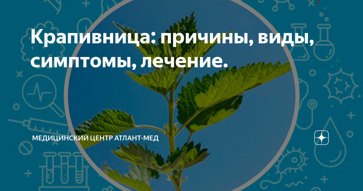 Крапивница: причины, виды, симптомы, лечение. | Медицинский центр ...