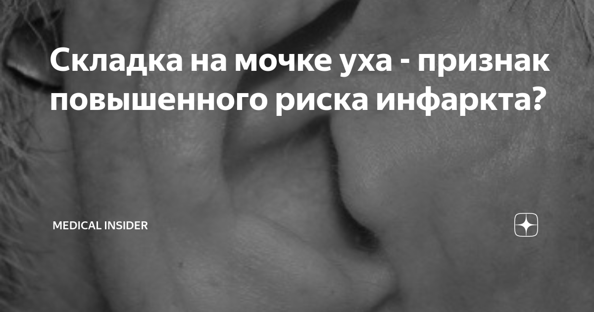 ᐈ Атерома за ухом, атерома мочки уха - причины, симптомы, лечение | Медицентр (Доктор ЛОР)