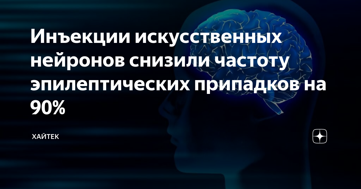 План обследования при впервые возникшем эпилептическом приступе