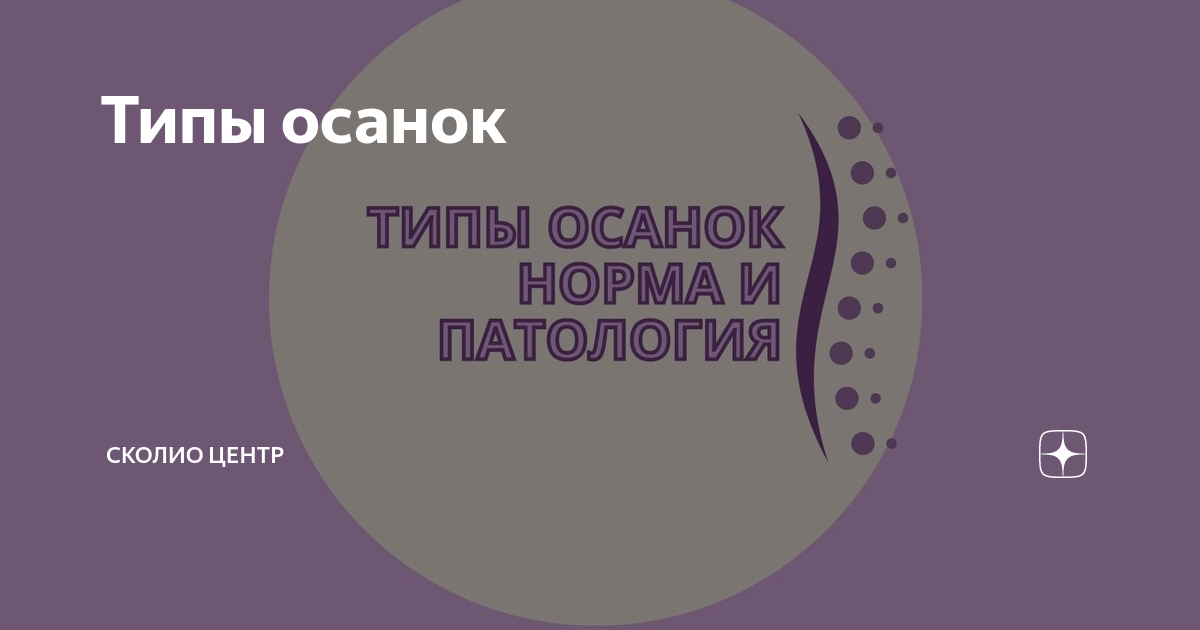 Типы осанок | Сколио центр | Дзен