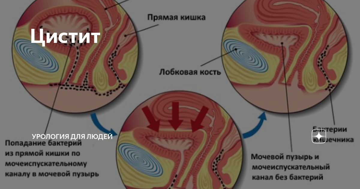 Боязнь секса - Сексология - - Здоровье nordwestspb.ru