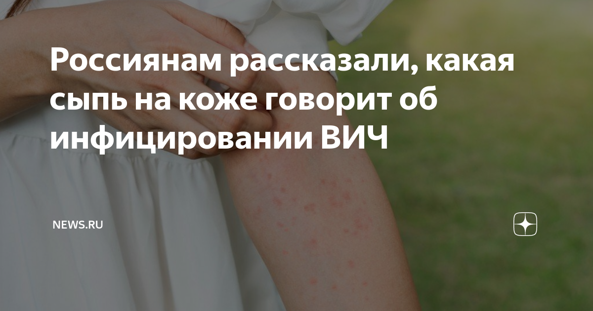Вич сыпь на коже как выглядит Презентация "ВИЧ-инфекция" по медицине скачать проект