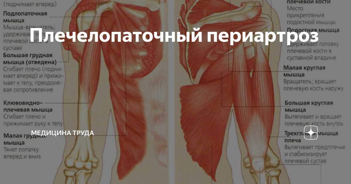 Плечелопаточный периартроз | Медицина труда | Дзен