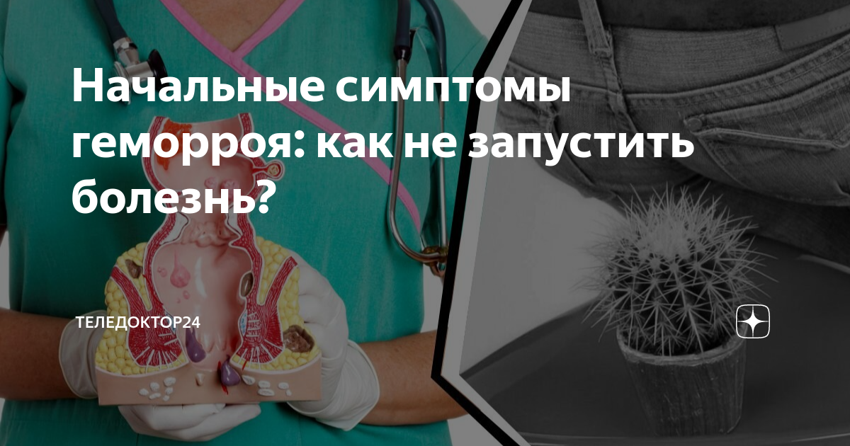 Начальные симптомы геморроя: как не запустить болезнь? | Теледоктор24 ...