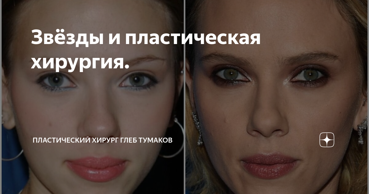 Хайдаров жена до и после пластики Как выглядит жена любимого пластического хирурга российских звезд (спойлер: ее о