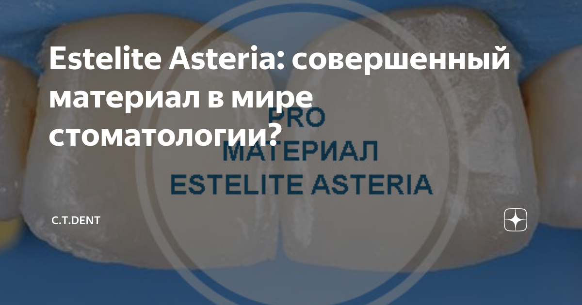 Estelite Asteria: совершенный материал в мире стоматологии? | C.T.DENT ...