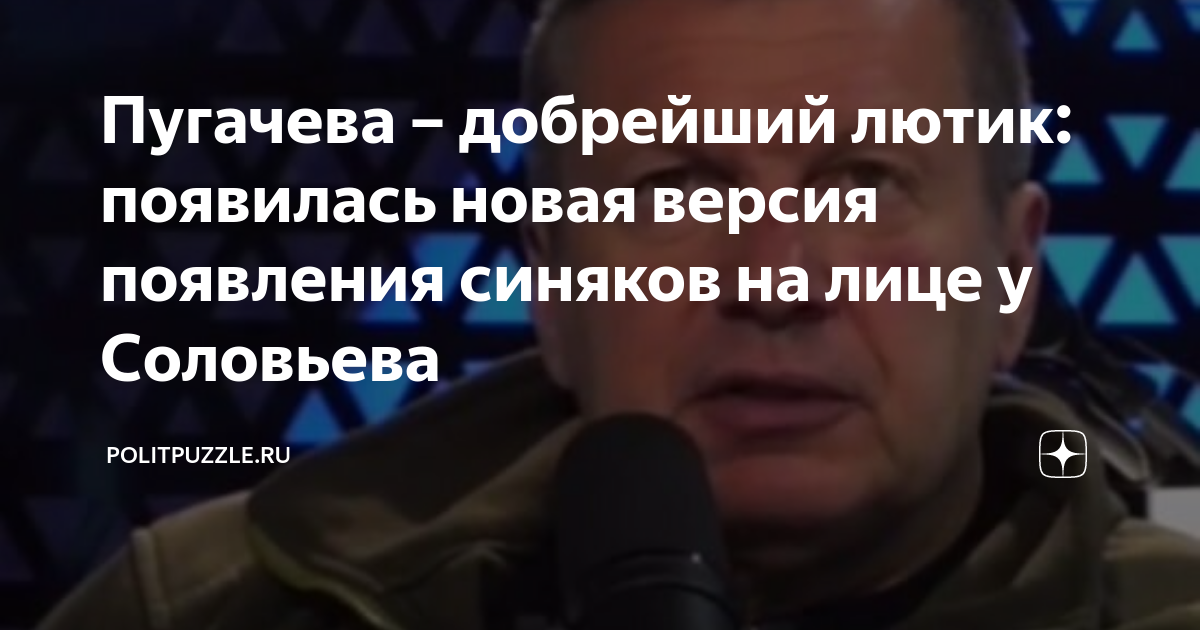 Пугачева – добрейший лютик: появилась новая версия появления синяков на ...