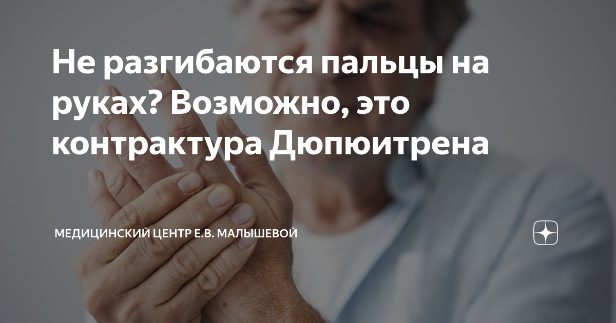 Болят пальцы в руках не согнуть лечение. Болят суставы рук Что делать? Болит большой палец на руке | Сеть клиник «ЗдравКлиник» Почему болят стопы ног и пятки чем лечить в домашних условиях - фото.