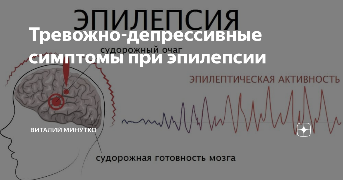 Тревожно-депрессивные симптомы при эпилепсии | Виталий Минутко | Дзен