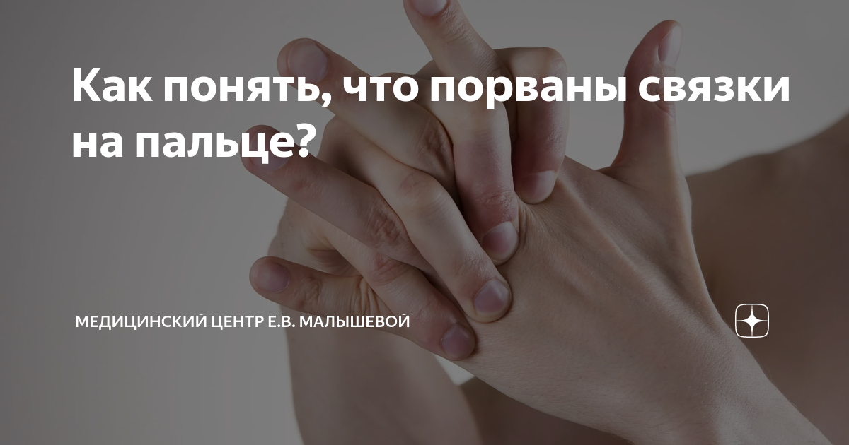 Как понять, что порваны связки на пальце? | Медицинский центр Е.В ...