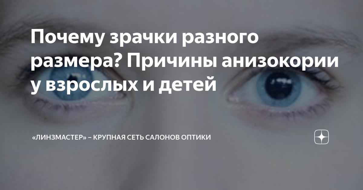 Почему зрачки разного размера? Причины анизокории у взрослых и детей ...