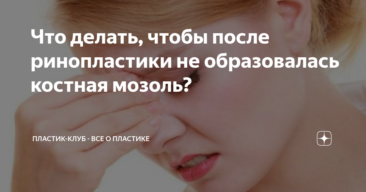Как выглядит костная мозоль после ринопластики Вечер после операции. Блог проекта OMORFIA