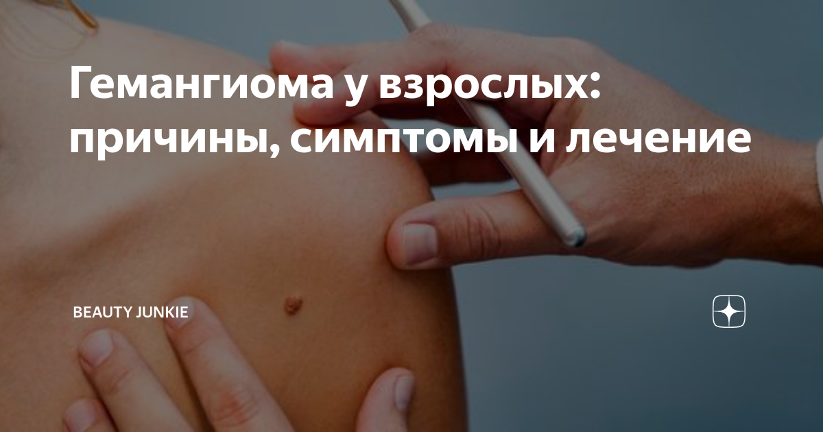 Гемангиома кожи фото у взрослых лечение