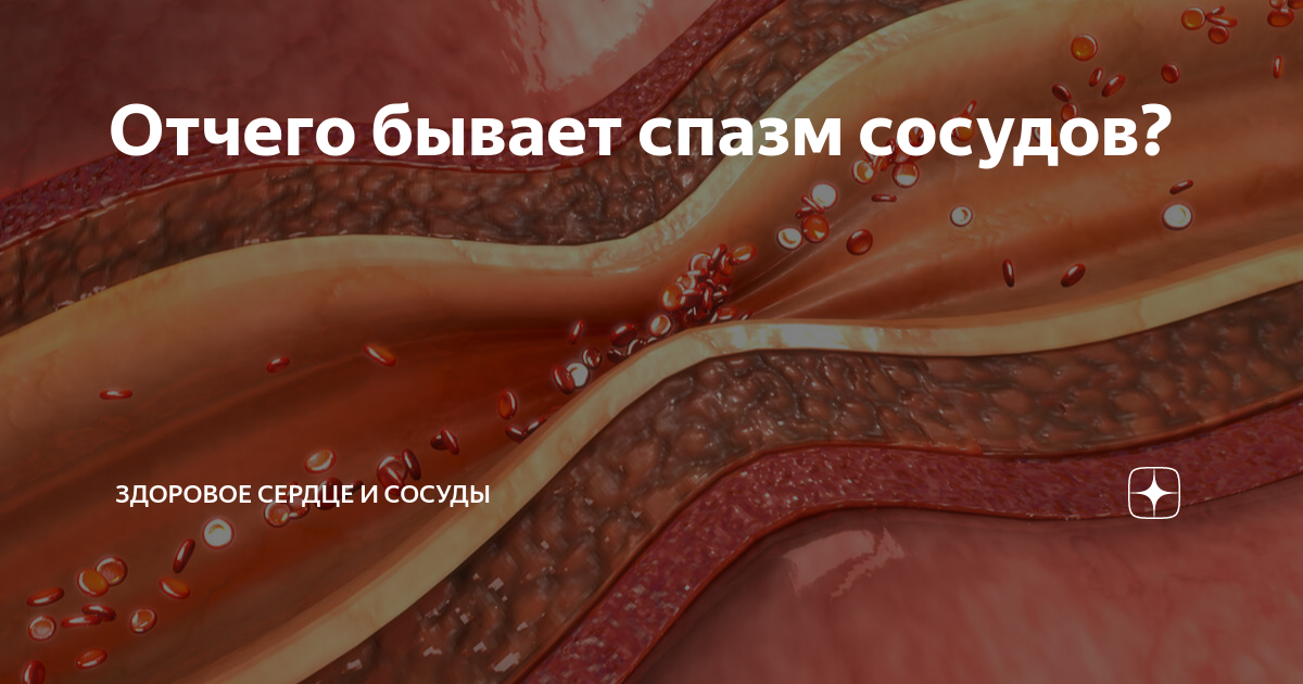 Васкулит - симптомы, причины, диагностика и лечение воспаления сосудов | Клиника «Наедине»