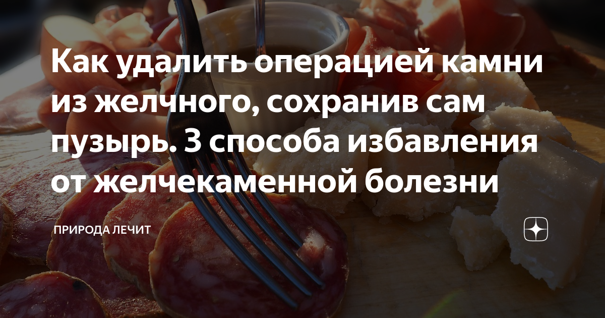 можно ли удалить камни из желчного без удаления желчного