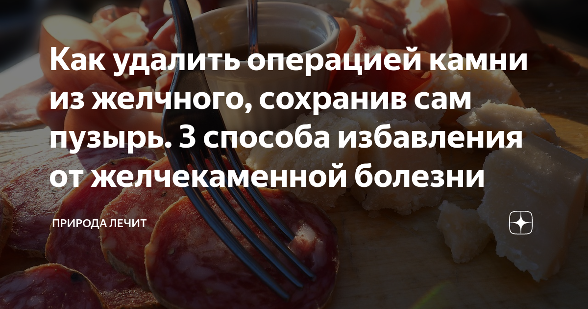 Желчный камень операция отзывы