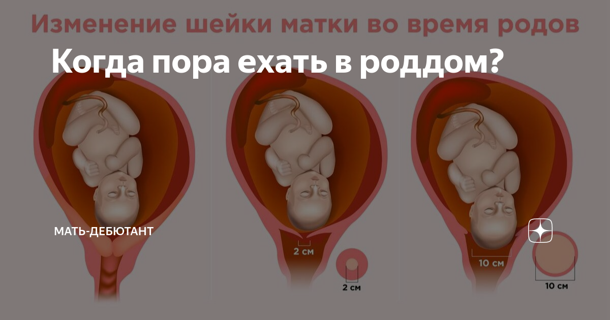 Начало родов (возможные сценарии). Неотложные состояния