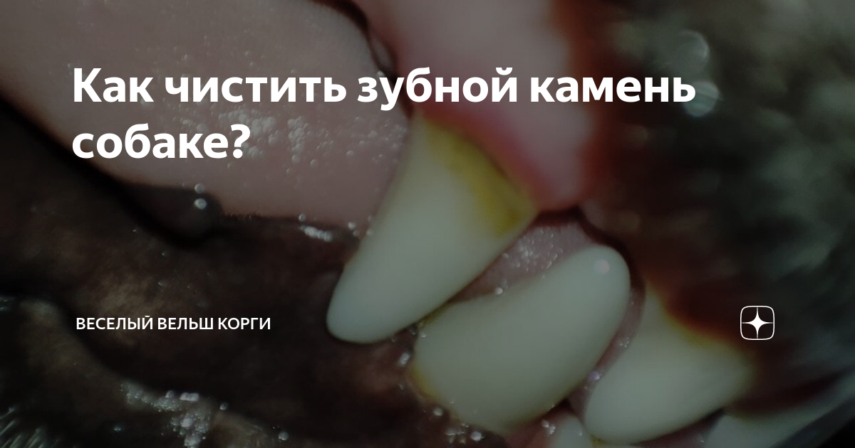 Зубной камень — что это и как с ним бороться?